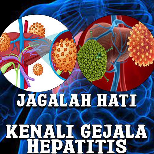 Hepatitis – Jenis, Gejala, dan Penanganan yang Tepat