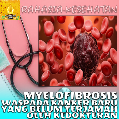 Myelofibrosis Jenis Kanker Misterius yang Belum Terjamah Ilmuan