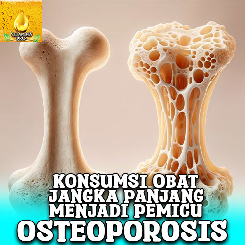 Osteoporosis Dampak dari Beberapa Obat