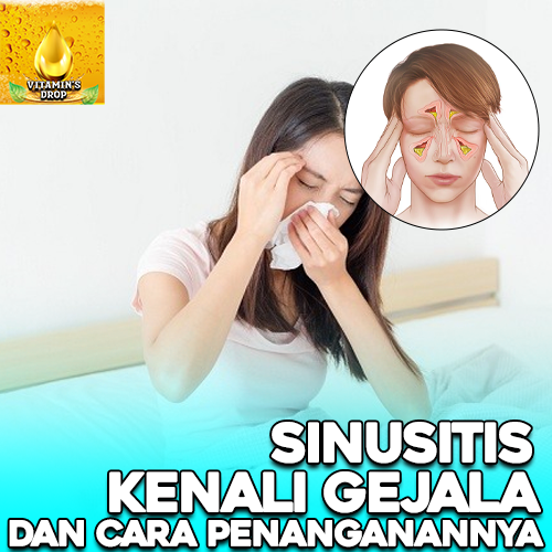 Sinusitis Bahaya Gangguan Pernapasan yang Harus Diwaspadai