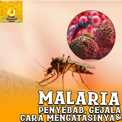 Malaria : Kenali Gejala, Penyebab Hingga Cara Mengatasinya