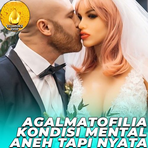 Agalmatofilia: Kondisi Mental Aneh tapi Nyata