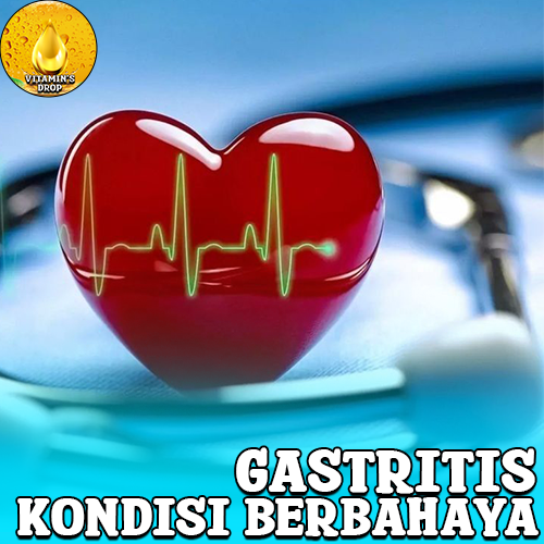 Gastritis Kondisi Berbahaya yang Dapat Berakibat Fatal