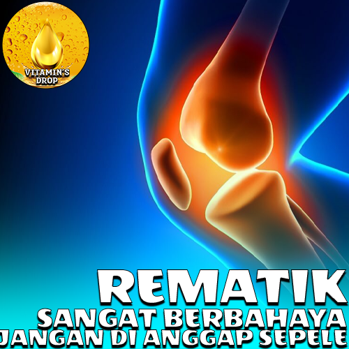 Rematik Jangan Dianggap Sepele Berikut Alasannya