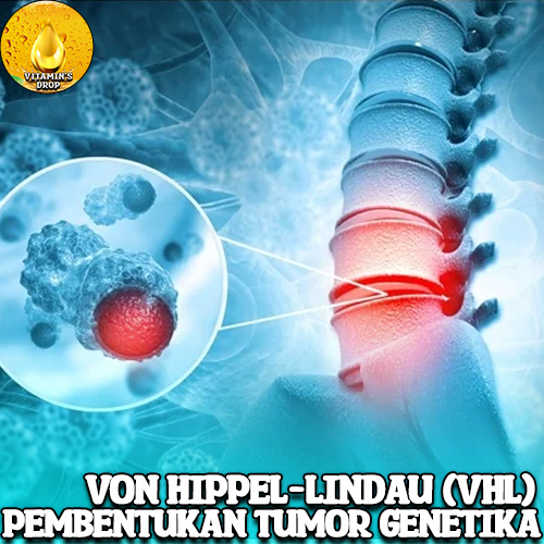 Von Hippel-Lindau (VHL) Pembentukan Tumor Genetika