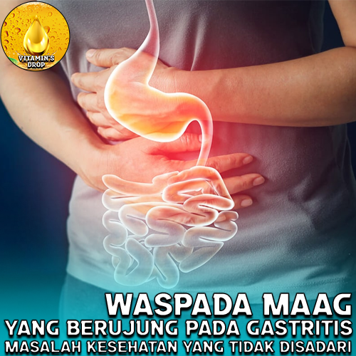 Waspada Maag yang Berujung pada Gastritis