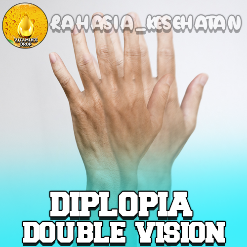 Diplopia – Double Vision Kenali Gejala dan Penyebabnya