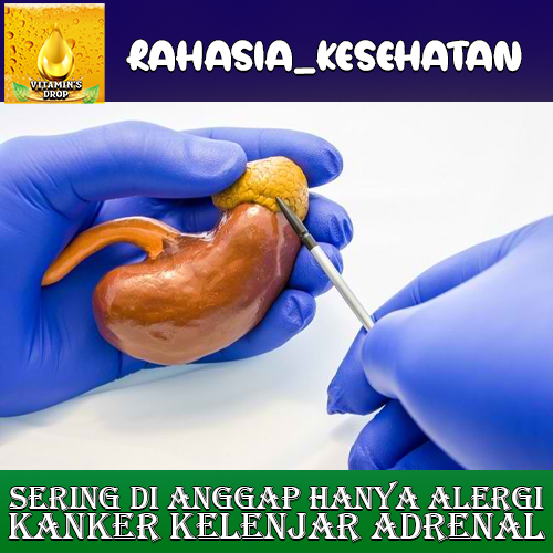 Kanker Kelenjar Adrenal Sering Di Sangka Alergi Biasa