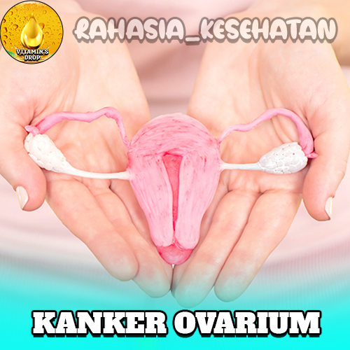 Kanker Ovarium Ayo Kupas Tuntas dan Kenali Lebih Dalam!