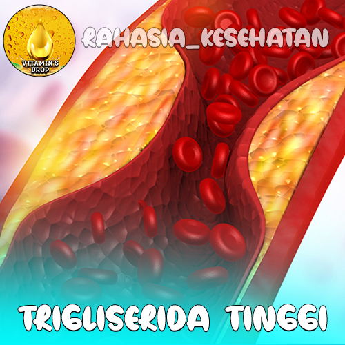 Trigliserida Tinggi Penyebab, Risiko, dan Cara Pengelolaannya