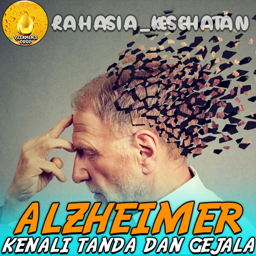 Alzheimer Kenali Tanda-tanda dan Gejala Penyakit Ini