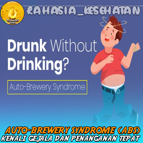 Auto-Brewery Syndrome (ABS) Kenali Gejala dan Penanganan Tepat