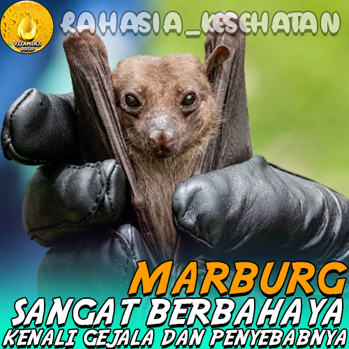 Marburg Sangat Berbahaya Kenali Gejala dan Penyebabnya