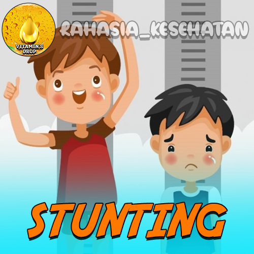 Stunting Isu Kesehatan Global Yang Jarang Diketahui