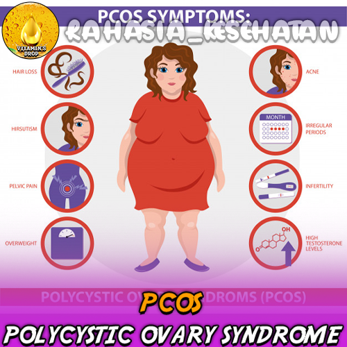 Mengenal PCOS: Gejala, Penyebab, dan Pengelolaannya