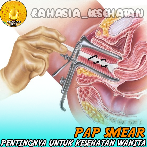 Pap Smear Pentingnya untuk Kesehatan Wanita