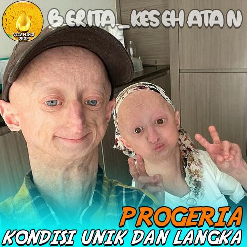 Progeria Kondisi Unik dan Langka