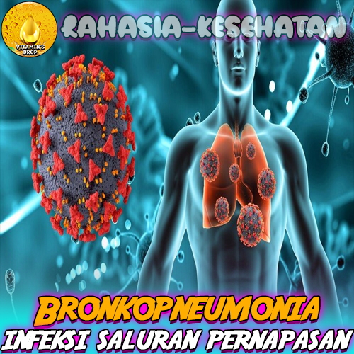 Bronkopneumonia Apa Itu? dan Kenali Lebih Jauh!