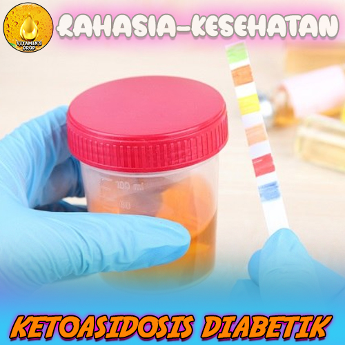 Ketoasidosis Diabetik Kenali dan Waspada