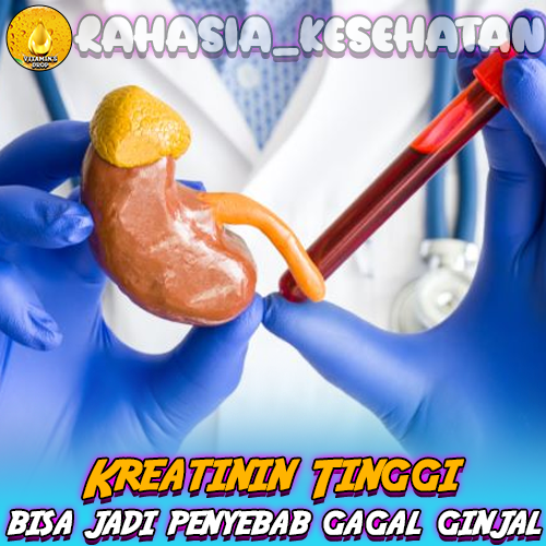 Kreatinin Tinggi: Kenali Penyebab dan Efeknya