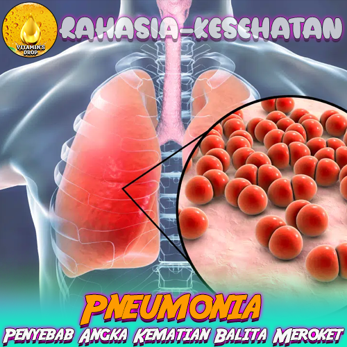 Pneumonia: Penyebab Angka Kematian Balita Meroket