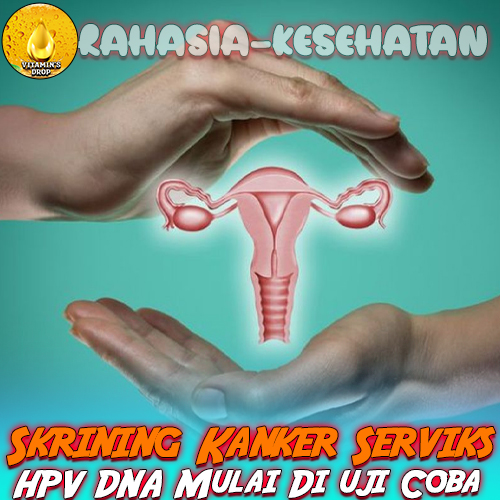 Skrining Kanker Serviks dengan HPV DNA Mulai Di uji Coba