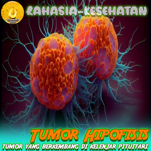 Tumor Hipofisis – Apa Itu? Apa Penyebabnya? Ayo Simak!