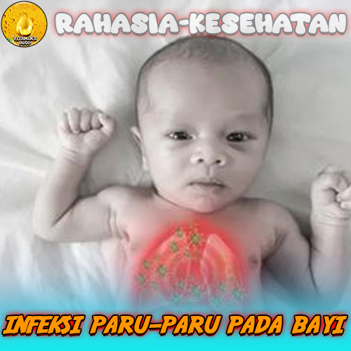 Infeksi Paru-Paru pada Bayi Kenali Lebih Lanjut