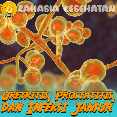 Uretritis, Prostatitis, dan Infeksi Jamur – Kenali Penyebabnya