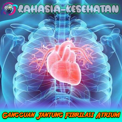 Gangguan Jantung Fibrilasi Atrium: Apa Itu?