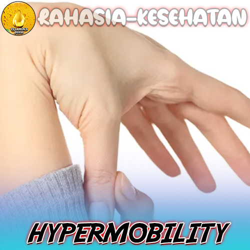 Hypermobility Simak dan Pelajari Lebih Lanjut Tentang Kondisi Ini