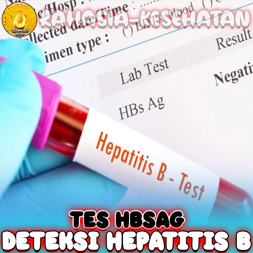 Tes HBsAg untuk Deteksi Hepatitis B: Ayo Simak Pentingnya!