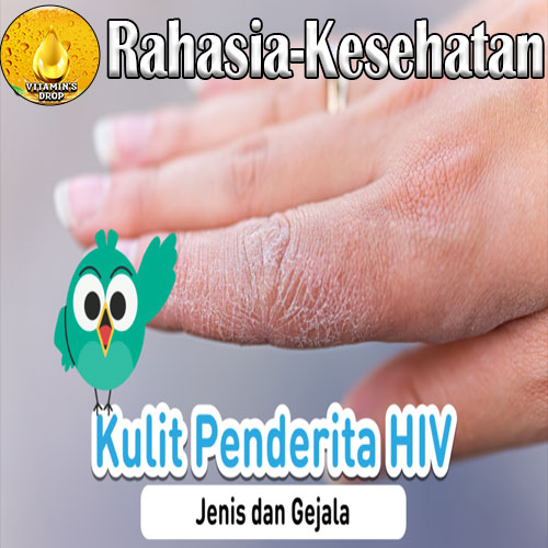 Kenali Ciri-Ciri HIV