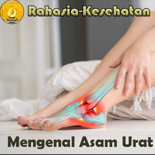Mengenal Asam Urat