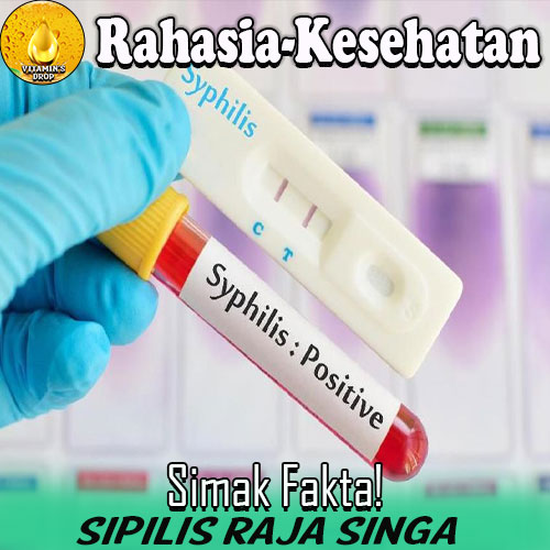 Sipilis dan Raja Singa Menyerang Kaum Hawa – Simak Fakta!