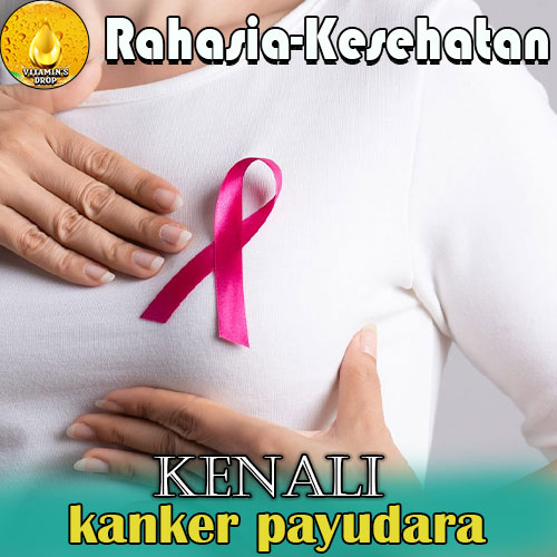 Kanker Payudara Kenali, Cegah, dan Lawan Sejak Dini