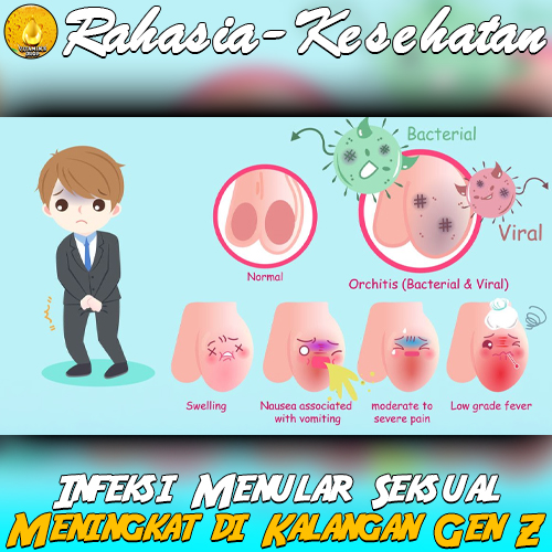 Infeksi Menular Seksual Meningkat di Kalangan Gen Z