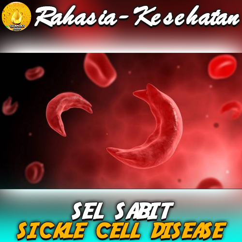 Sel Sabit – Apa Itu? Simak Dampak dan Penyebabnya