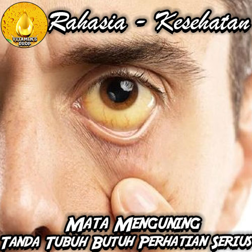 Kenali Penyebab Mata Menguning: Tanda Tubuh Butuh Perhatian Serius