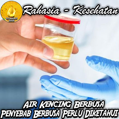 Penyebab Air Kencing Berbusa yang Perlu Diketahui dan Diwaspadai