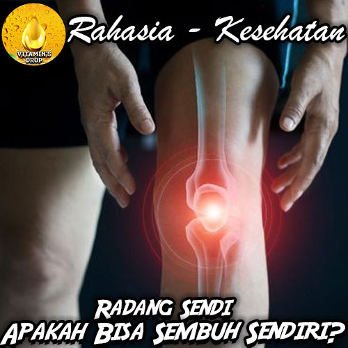Apakah Radang Sendi Bisa Sembuh Sendiri? Ini Penjelasannya
